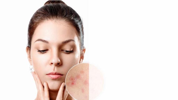 drsiddiquiskinclinic offer 3